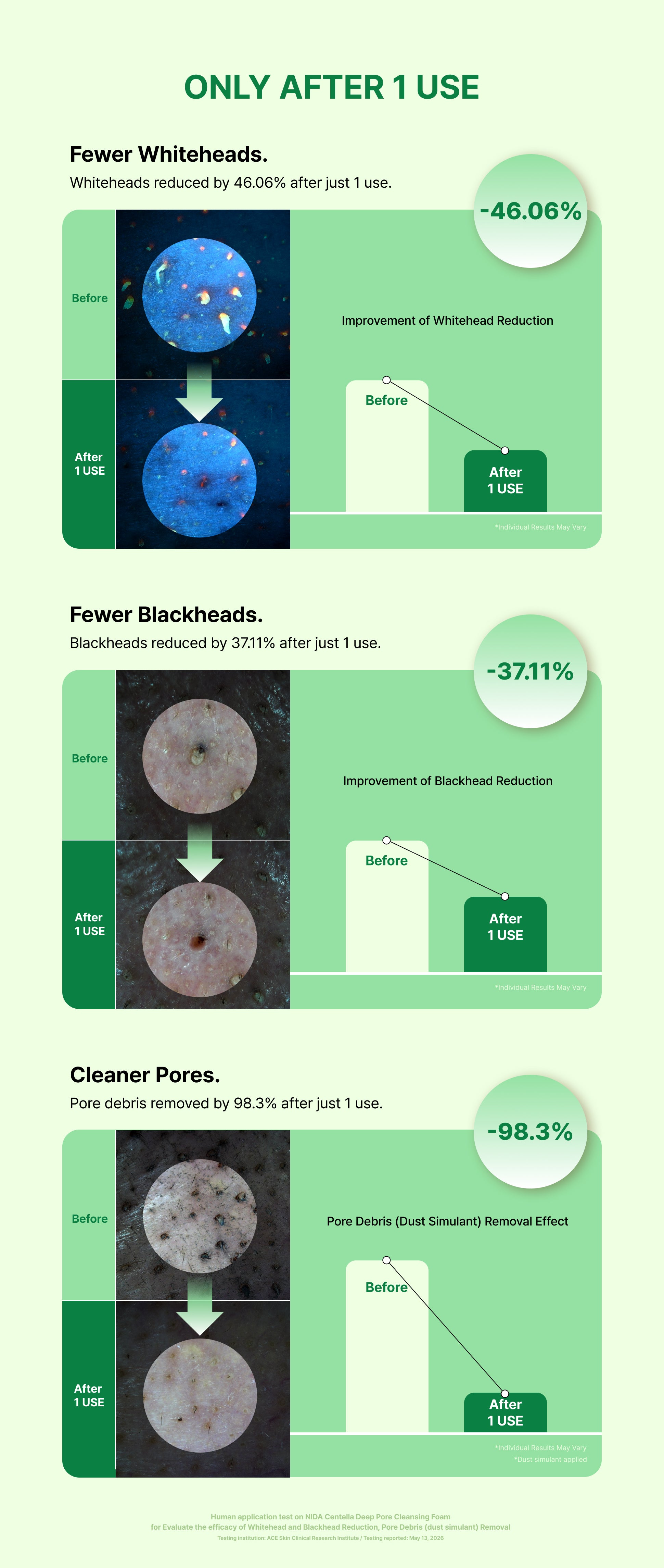 Microscope images of whiteheads before and after 1 use